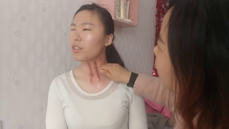 揪痧疗法揭秘，传统与时尚融合的新时代揪痧视频发布！